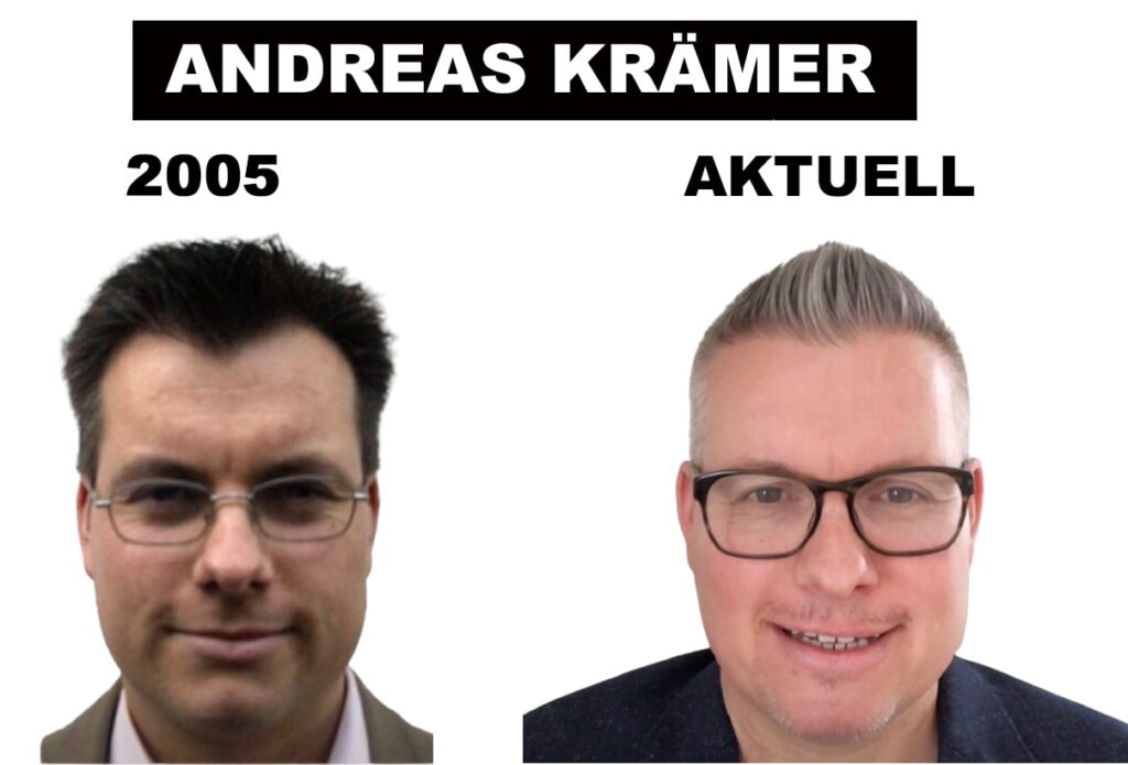 Andreas Krämer von Hairforlife.ch Schweiz vor und nach Haartransplantation