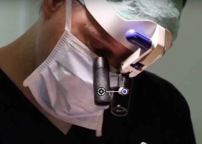FUE Haartransplantation 8 faches Kopflupen-Mikroskop 