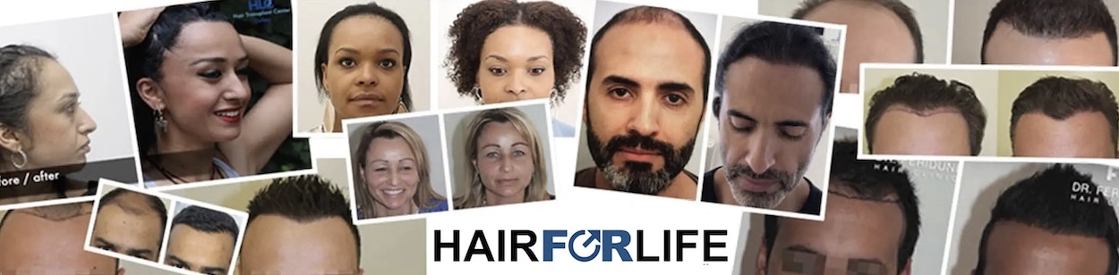 Haartransplantation Online Beratung Hairforlife.ch