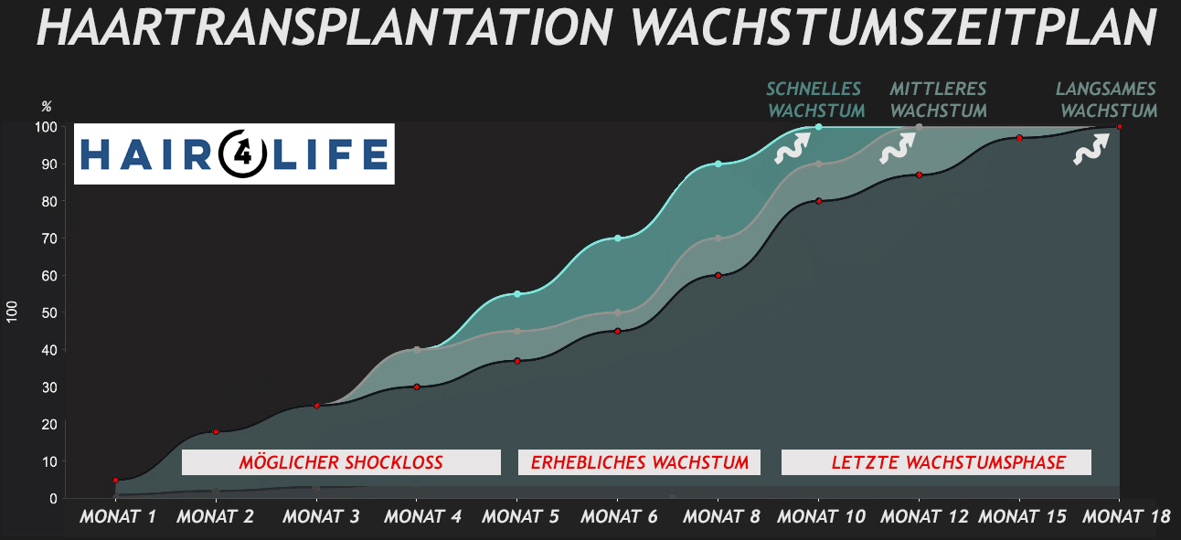 Growth-Timeline Wachstumszeitplan nach Haartransplantation - Hairforlife.ch