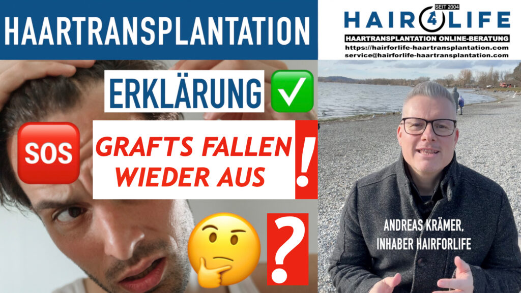 Haartransplantation: Verpflanzte Grafts fallen aus