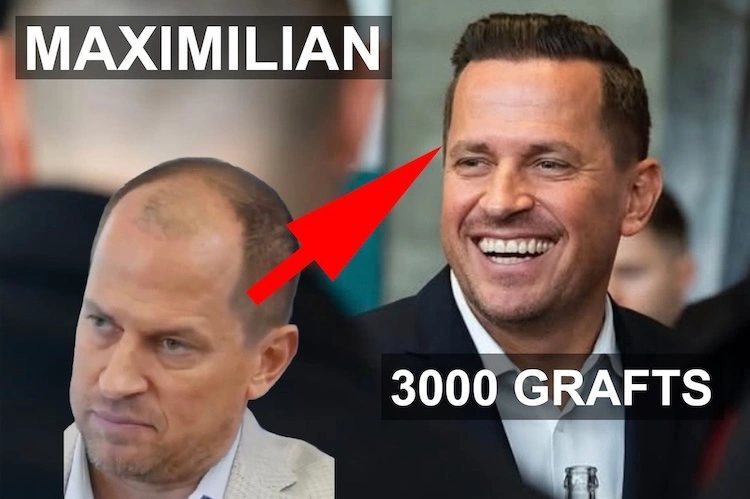 Maximilian Wolf – Ergebnis Bild 2