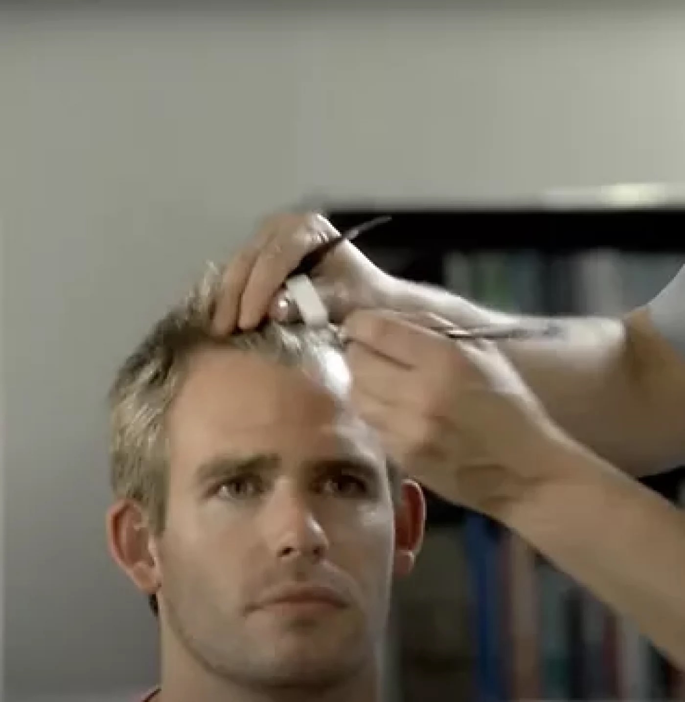 Haartransplantation Schweiz – unabhängige Online-Beratung vom Experten | Hairforlife