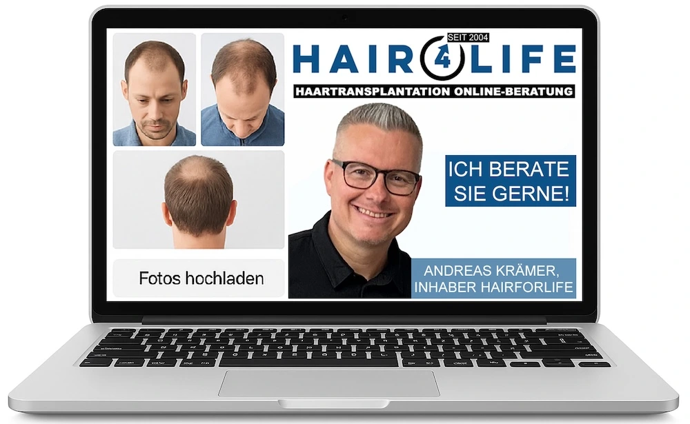 Hairforlife.ch Online-Beratung – Fotos hochladen