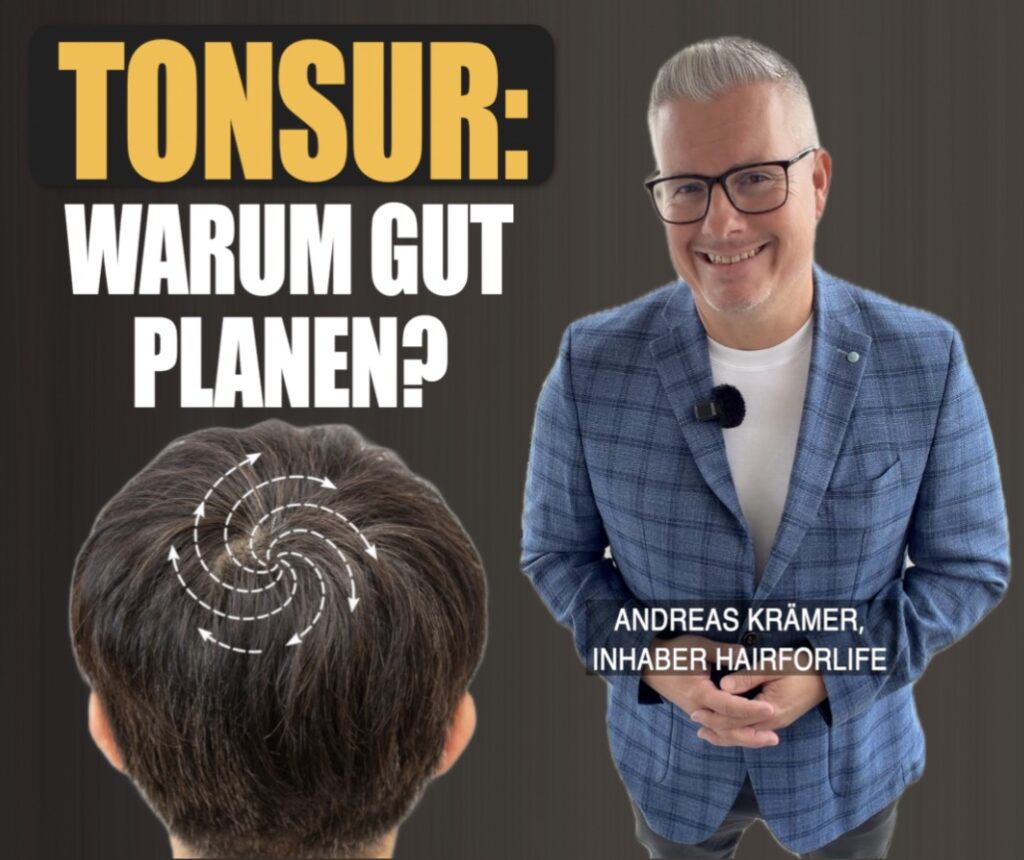 Haartransplantation Tonsur: Warum gut planen? Wichtige Planung – Hairforlife.ch