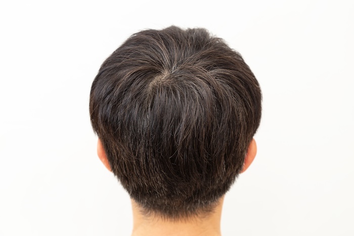 Natürlicher voller Haarwirbel mit teilweise sichtbarer Kopfhaut