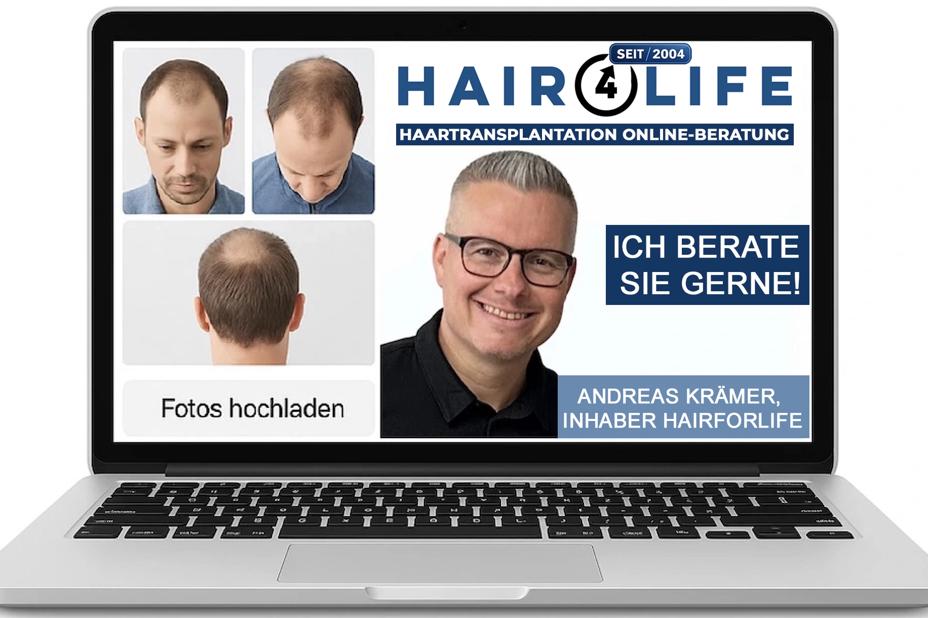Hairforlife.ch Online-Beratung – Fotos hochladen